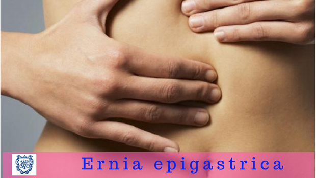 Ernia epigastrica - Il Blog del Prof. Paolo Barillari