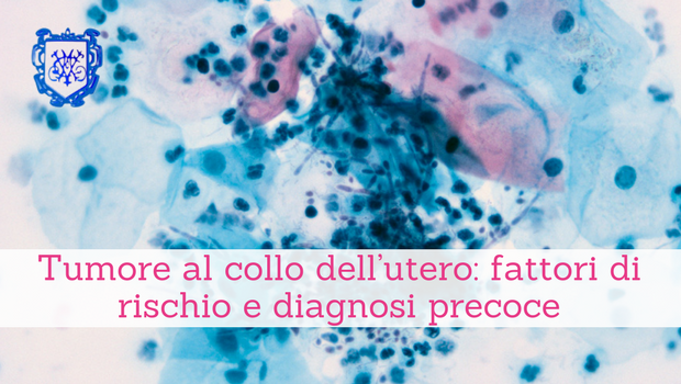 Tumore al collo dell’utero, fattori di rischio e diagnosi precoce - Il Blog del Prof. Paolo Barillari
