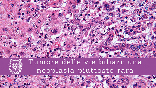Tumore delle vie biliari, una neoplasia piuttosto rara - Il Blog del Prof. Paolo Barillari