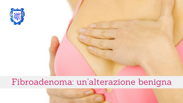 Fibroadenoma, un’alterazione benigna - Il Blog del Prof. Paolo Barillari