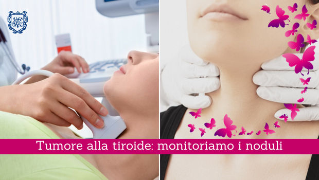 Tumore alla tiroide, monitoriamo i noduli - Il Blog del Prof. Paolo Barillari