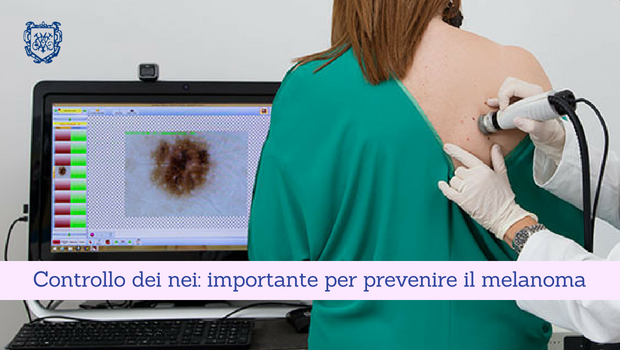Controllo dei nei, importante per prevenire il melanoma - Il Blog del Prof. Paolo Barillari