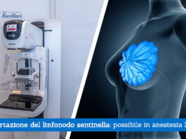 Asportazione del linfonodo sentinella, possibile in anestesia locale - Il Blog del Prof. Paolo Barillari