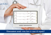 Ulcerazioni anali, cosa fare in caso di ragadi - Il Blog del Prof. Paolo Barillari
