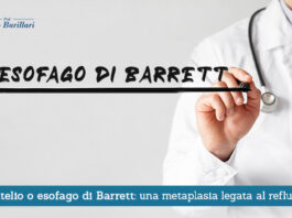 Epitelio o esofago di Barrett, una metaplasia legata al reflusso - Il Blog del Prof. Paolo Barillari