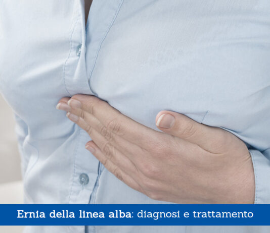 Ernia della linea alba, diagnosi e trattamento - Il Blog del Prof. Paolo Barillari