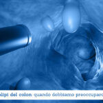 Polipi del colon, quando dobbiamo preoccuparci - Il Blog del Prof. Paolo Barillari