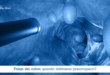 Polipi del colon, quando dobbiamo preoccuparci - Il Blog del Prof. Paolo Barillari
