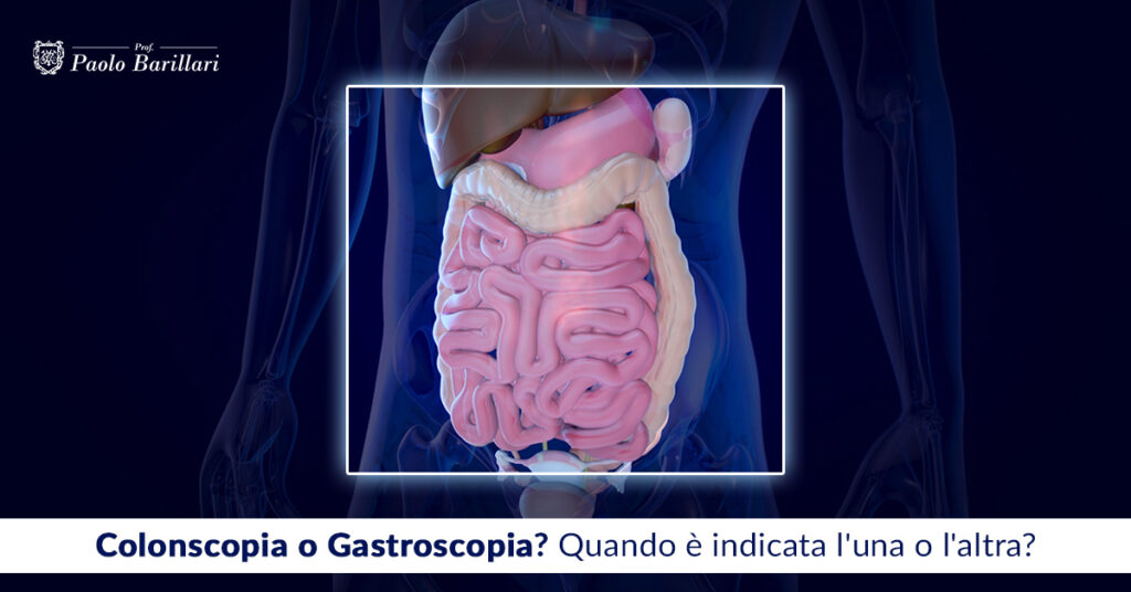 Colonscopia o Gastroscopia? - Il Blog del Prof. Paolo Barillari